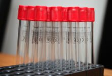 Quest、Labcorp 化验账单高得离谱?核对与申诉全攻略-美国通