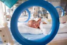 早产儿 NICU 住几周,账单吓死人?保险覆盖与减免全解-美国通